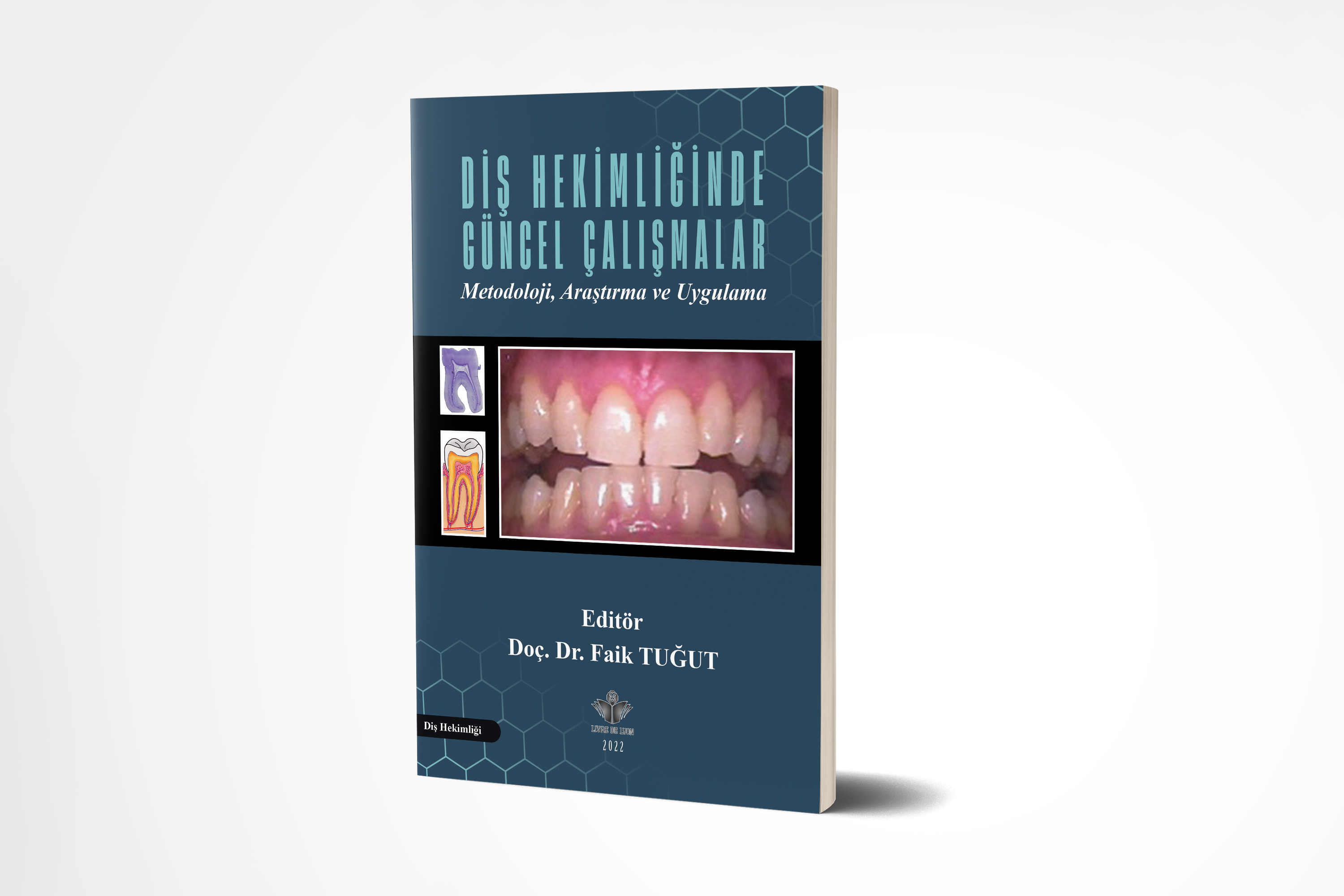 Diş Hekimliğinde Güncel Çalışmalar Metodoloji, Araştırma ve Uygulama